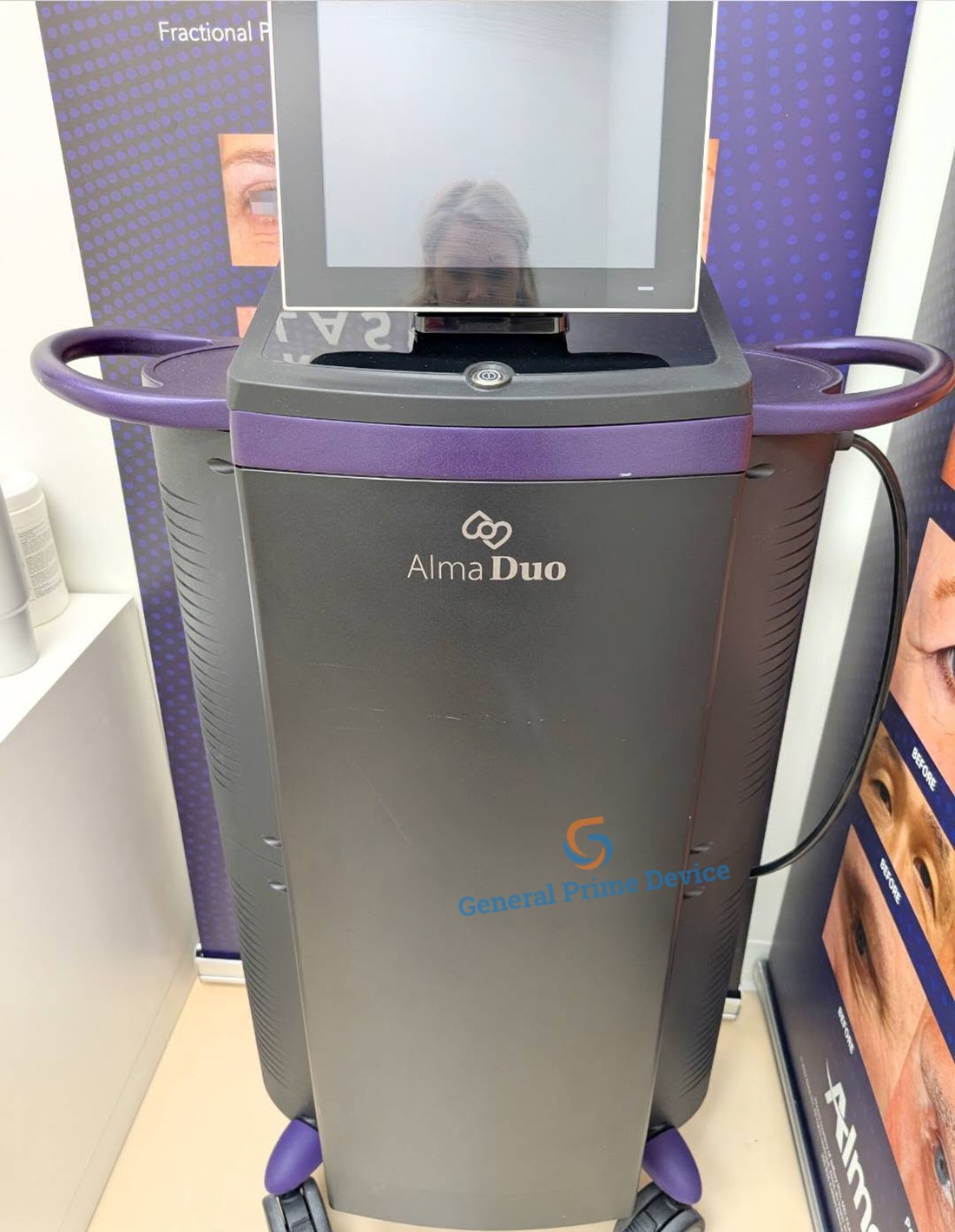 Alma Duo Shockwave Therapy Device