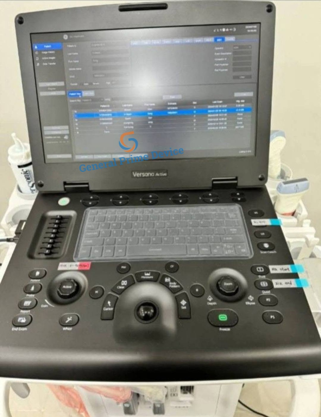 GE Versana Active Portable Ultrasound